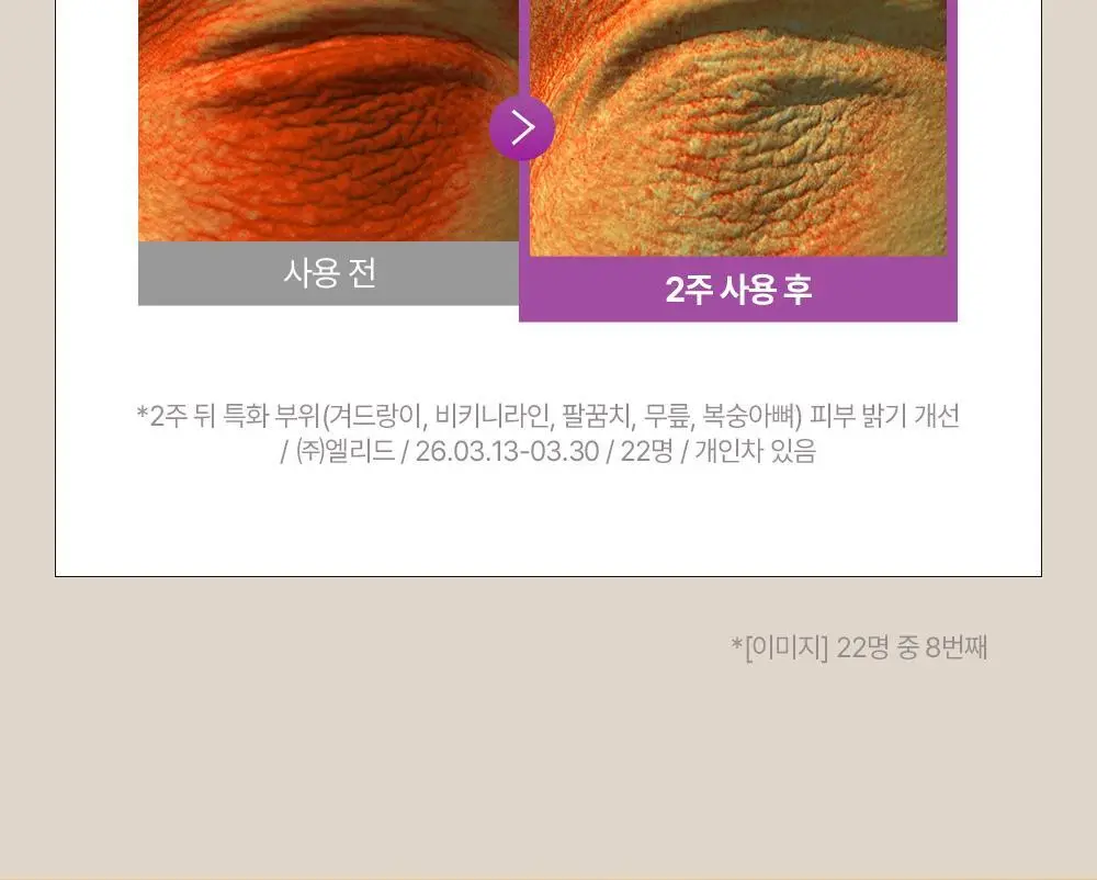 [NEW] 비욘드 바디타민 알파 브라이트닝 스팟 바디 세럼 80ml 상세페이지 22